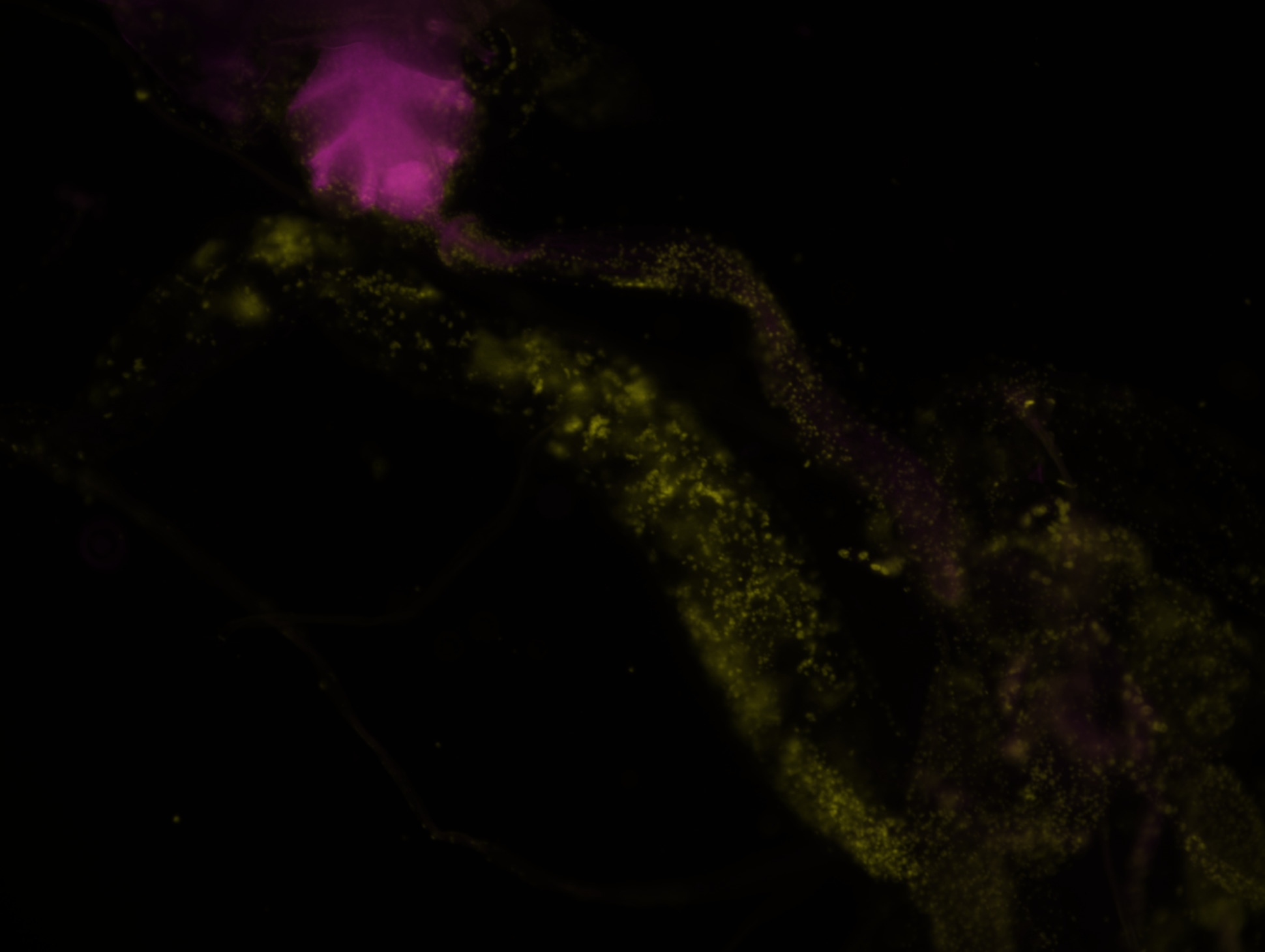 DAPI and GFP labeled Midgut